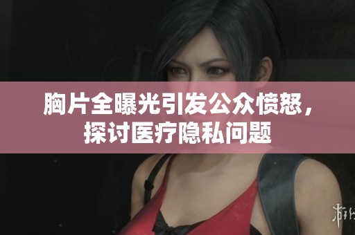 胸片全曝光引发公众愤怒，探讨医疗隐私问题